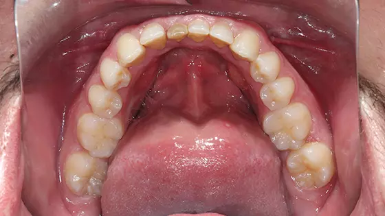 Tenha o sorriso mais natural sem cirurgia! 