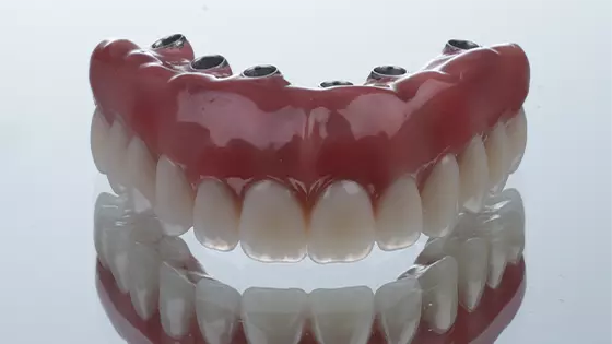 Implante Dentário e Prótese em Goiânia: restaure sua arcada dentária e volte a gostar de sorrir